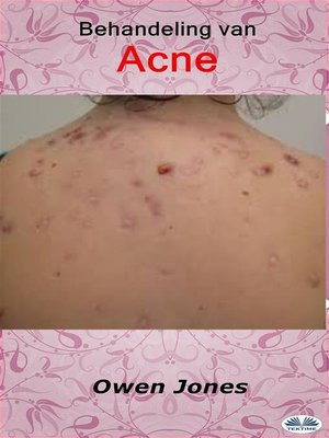 cover image of Behandeling Van Acne